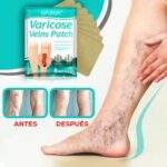 PARCHES PARA VARICES 