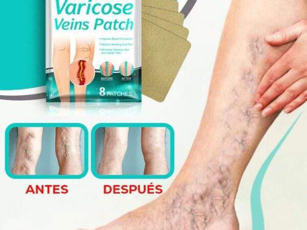 PARCHES PARA VARICES 